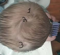 Crown creations is where creativity responds to the beauty within. My Son Has 3 Whorls On The Crown Of His Head Mildlyinteresting