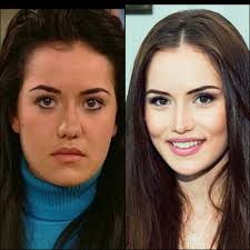 Bu zamana kadar en ufak bir estetik yaptırmadım demişti. Fahriye Evcen Den Estetik Iddialara Fotografli Yanit Geldi