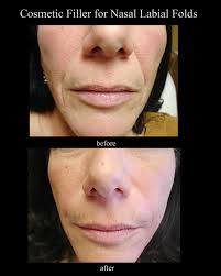 Before and After Photos at Cynthia Salter-Lewis, MD