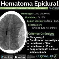 Como estudiar para el #enarm2021 | técnicas para pasar a la primera. 268 Me Gusta 0 Comentarios Consalud Enarm Consaludenarm En Instagram Enarm 2021 Beca 2x1 O 40 Off Preventa Aparta Con Epidural Instagram Tips