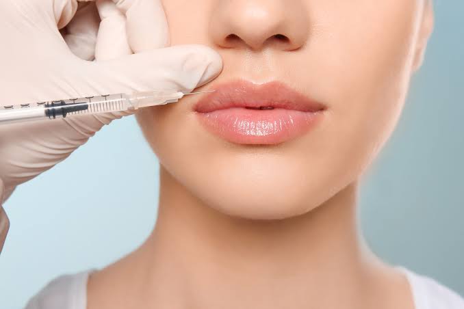 Enhancing Your Natural Beauty: Exploring the World of Lip Fillers