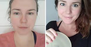 Vondt i brystet gravid smerter i brystene, veiviser. Susanna Om Brystimplantatet Det Gjorde Vondt A Eksistere