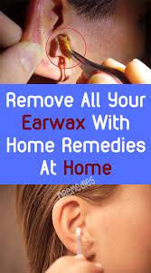Remove All Your Earwax With Home Remedies At Home Fitness Beauty Hair Health Diy Skin Pore Skincare Skintags Ski Ear Wax Ear Wax Removal Home Remedies