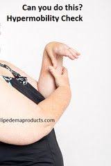Pin On Lipedema Dercum S Survivalist