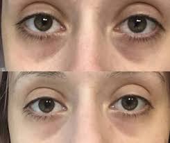 25 Skincare Products For Anyone With A Sensitive Nose