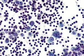 Check spelling or type a new query. Mesothelial Cytopathology Libre Pathology