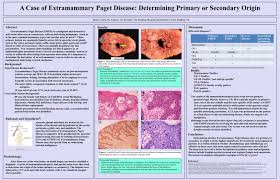 A Case Of Extramammary Paget Disease Determining Primary Or Secondary Abstract Results