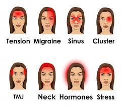 Table of contents a migraine is usually an intense pounding headache that can last for hours or even. Types Of Headache Illustrated On A Woman Face Headache Types Headache Treatment Natural Headache