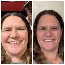 Just did 25% WC and trimmed a bit.