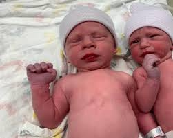 Newborn twins born from embryos frozen 30 years ago