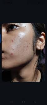 Dr. Satish Chand Aggarwal (Aggrwal Skin Clinic) in Kamla Nagar,Agra