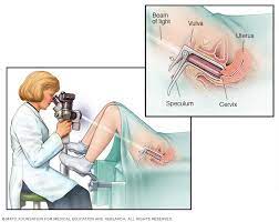 Colposcopia Mayo Clinic