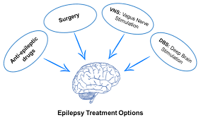 A Review On Natural Therapy For Seizure Disorders Medcrave Online