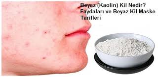 Beyaz Kaolin Kil Nedir Faydalari Ve Beyaz Kil Maske Tarifleri