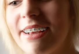 See more ideas about best smile quotes, smile quotes, good smile. Slideshow How To Get A Brighter Better Smile Dental Bridge Cost Dental Bridge Dental Cosmetics