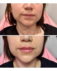 𝑹𝒚𝒂𝒏 𝑯𝒖𝒍𝒊𝒏𝒈