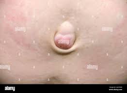 Image result for Umbilicus