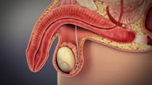 男性性功能障礙的種類與病因- 絡合堂