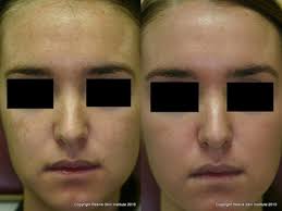 Barry Resnik, MD, Board Certified Dermatologist