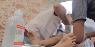 Seseorang dikatakan mengalami darah rendah jika memiliki tekanan darah di bawah 90/60 mmhg. Sejumlah Kondisi Yang Normal Terjadi Usai Anak Menjalani Sunat Merdeka Com