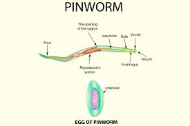 pinworms during pregnancy causes symptoms and prevention