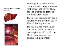 They come from epitelialny and soyedinitelnotkanny elements of a liver or bilious channels. Liver Anatomy And Physiology The Liver Is Divided