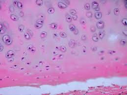 Check spelling or type a new query. Cartilage Histology Hyaline Cartilage Histology Slide Hyaline Cartilage Histology Slides Microscopic Cells
