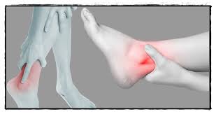 Tulang kaki kanan sering ngilu. Cara Menghilangkan Nyeri Di Pergelangan Kaki Kanan Dan Kiri Terbukti Mujarab