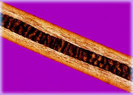 Many tv and film characters have adorned the look in the past, one famously known as the 60s sitcom. Skunk Hair Olympus Ls