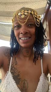 How to cope with the discomfort and frustration of having braces?