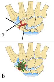 The Cureus Journal Of Medical Science Peer Reviewed Open