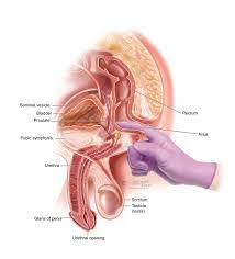 There are millions of men who have had theirs removed for a couple of reasons, cancer or i think bhp. Prostatitis Infection Of The Prostate Symptoms Diagnosis Treatment Urology Care Foundation