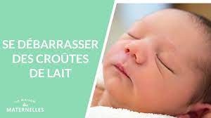 Les croûtes de lait sont un problème courant chez le nourrisson au cours des six premiers mois. Se Debarrasser Des Croutes De Lait La Maison Des Maternelles Lmdm Youtube