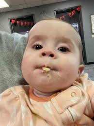 Meet Chloe. My Kleefstra baby 💗 she is 8 months old today and we just left  her genetic counseling appointment. We live in a small town in Mississippi.  Her geneticist is not