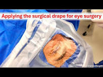 How I apply the surgical drape for eye (cataract) surgery. Shannon Wong, MD.