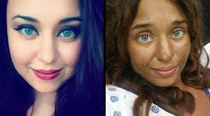 In August 2017, Lisa Theris, 25, was lost for 28 days in the dense forests  of Midland, Alabama. Without shoes, a phone, or supplies, she survived by  eating berries, wild mushrooms, and