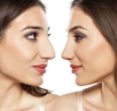 عمليات تجميل الانف وجهك هو مظهرك وجملك والانف تبرز جمال الوجه