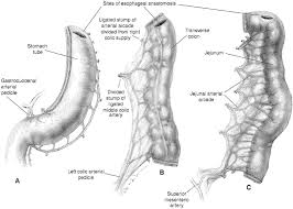 Colocolostomy cellulitis is a severe pathology, which in most cases has odontotaenius character, i.e. Esophageal Anastomosis Operative Techniques In Thoracic And Cardiovascular Surgery