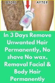 Hair Removal Permanent Facials In 3 Days Remove Unwanted Hair Permanently No Sha Unwanted Hair Removal How To Remove Unwanted Hair Natural Hair Removal