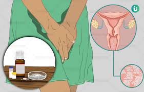 Homeopathic Treatment Medicines Remedies For Vaginal Yeast Infection Types Effectiveness And Risks