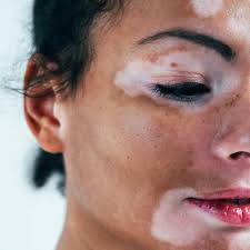 April“Nikki”Bedingfield,FNP-C