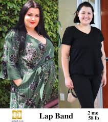 Pin On The Weight Loss Surgery Center Of Los Angeles