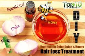 Other drugs associated with hair loss are blood thinners and medicines that treat high blood pressure, heart disease, arthritis, and depression. Homemade Remedy To Reduce Hair Loss Using Onion Juice Top 10 Home Remedies