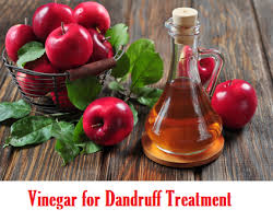 It not only weeds out dandruff but also stops hair fall and lends body and bounce to your hair. Can Having Dandruff Cause Hair Loss Facts And Information Paperblog