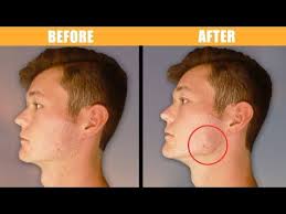 Exercises And Posture For Defined Jawline 4 Easy Steps Youtube Jawline Exercise Jawline Good Jawline