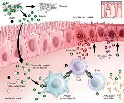 Celiac disease—the past, present, and future. Rise In Celiac Disease Spurs Research The Scientist Magazine