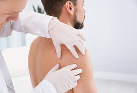 Ne doit pas être confondu avec hyposensibilisation. Melanome Metastatique Pleins Feux Sur De Nouvelles Possibilites Offertes Par L Immunotherapie Skin