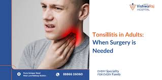 Image result for Tonsillitis
