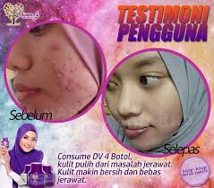 Dian'z Pixy Vitamin C & E