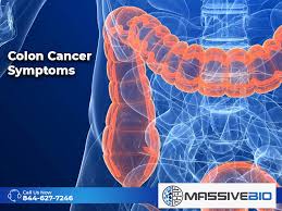Patients with colon cancer or rectal cancer may experience one or multiple symptoms. Colon Cancer Symptoms Risk Of Colon Cancer Massive Bio
